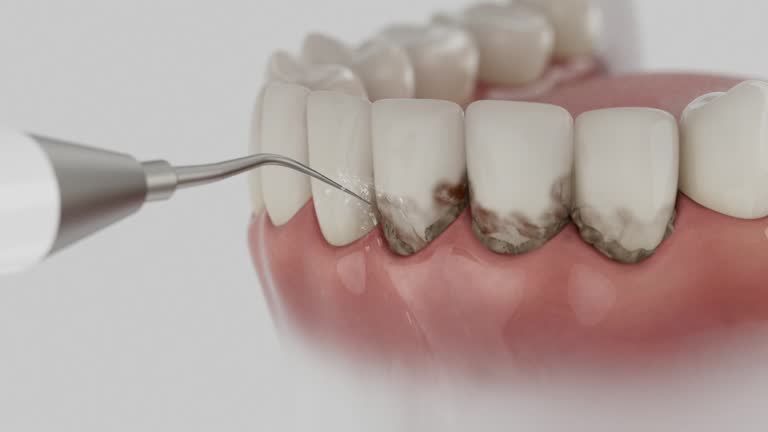 Reliable Emergency Dentist contractor in Cleburne, TX by Smile Center Dentistry